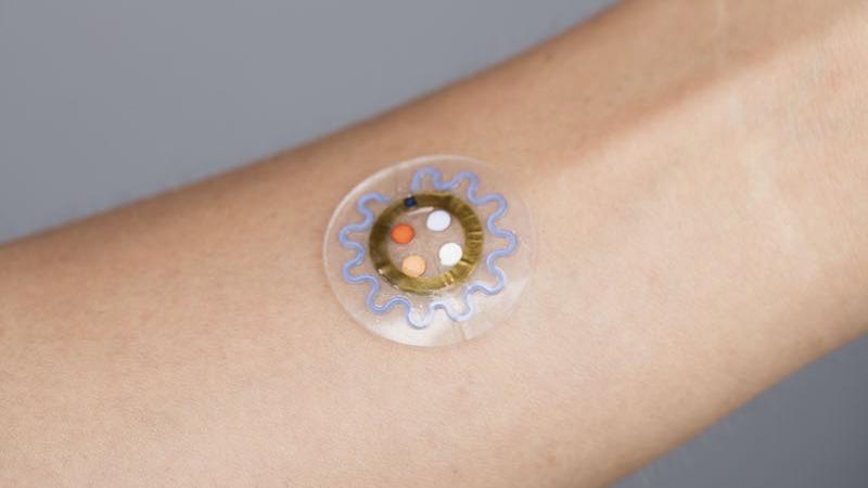 Wearable Technology May Provide Early Kidney Health Warning Signs
